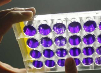 Alzheimer: enzima cerebral podría prevenir enfermedad neurodegenerativa