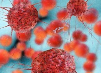 Cáncer de mama: droga existente se muestra prometedora en la prevención del grupo alto riesgo