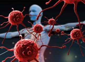 Enfermedades autoinmunes: Todo lo que necesitas saber