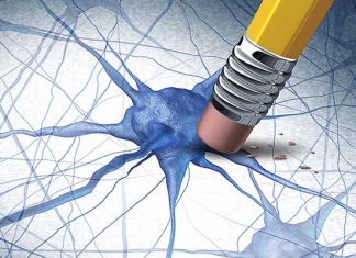 Alzheimer: ensayo de nuevo fármaco para eliminar placas en el cerebro que causan la enfermedad