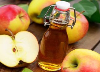 ¿Puede el vinagre de manzana ayudar a tratar la psoriasis?