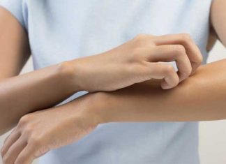 Fibromialgia y picazón: causas y tratamiento