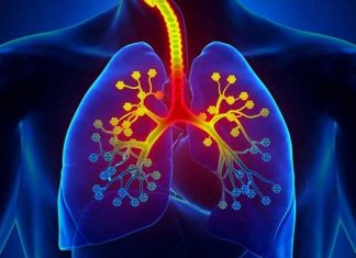 Neumonía y EPOC: ¿Cuál es la conexión?