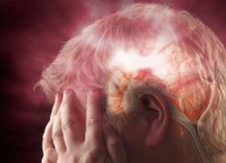 Hemorragia cerebral: causas, síntomas y tratamientos