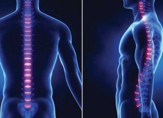 Seis consejos para la inclinación pélvica anterior
