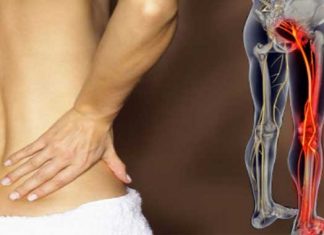 Ciática: Seis estiramientos para el alivio del dolor