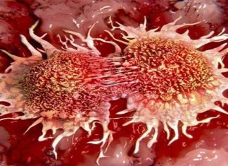Científicos pueden haber encontrado una manera de detener la metástasis