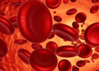 Anemia por deficiencia de hierro: Causas, síntomas y tratamiento