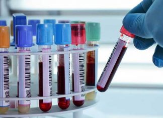 Hemoglobina corpuscular media en los análisis de sangre: ¿Qué significa?