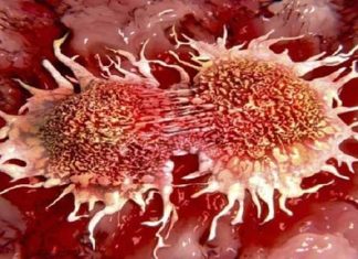 ¿Es esta la clave para evitar que el cáncer se propague?