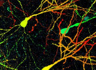 Los investigadores descubren las ‘células de ansiedad’ en el cerebro