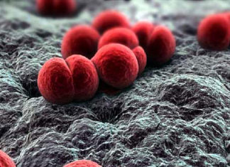 ¿Cuáles son los efectos de la meningitis?