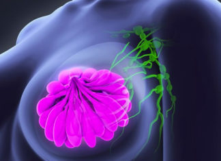 Se descubrió un nuevo regulador en células agresivas de cáncer de mama