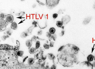 El virus HTLV-1 es común en partes de Australia