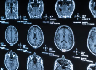 Nuevo objetivo farmacológico para la esquizofrenia